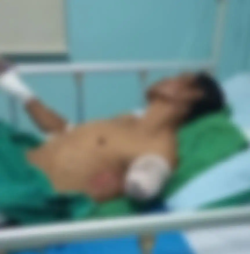 Tragedi Hilux di Kuday: Asep Kehilangan Tangan, Korban Cacat Seumur Hidup Menanti Keadilan